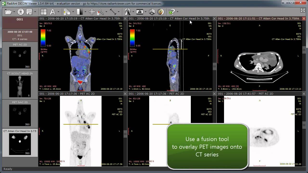 RadiAnt DICOM Viewer 2023.1 DICOM-PACS图像查看器