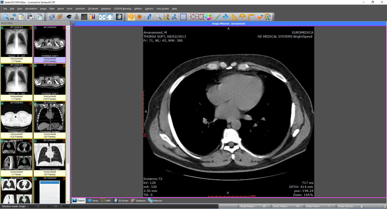 Sante DICOM Editor v10.0.8 DICOM编辑器